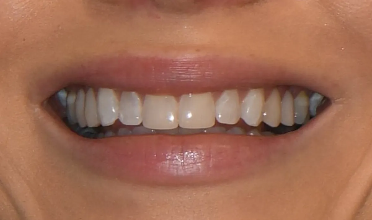 Before: Smile before the makeover